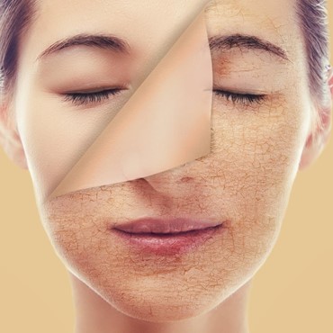 Các vấn đề về da cho thấy cơ thể đang thiếu collagen