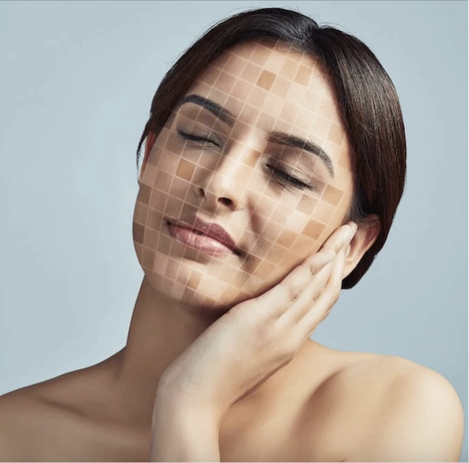 Hoạt Chất Vàng Trong Cách Trị Da Không Đều Màu Chuẩn Y Khoa