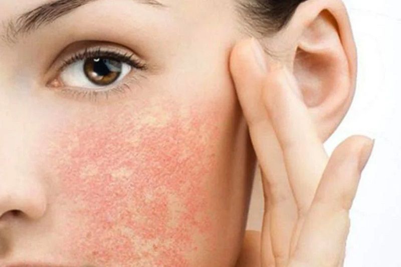 Dấu hiệu nhận biết và nguyên nhân khiến da bị kích ứng