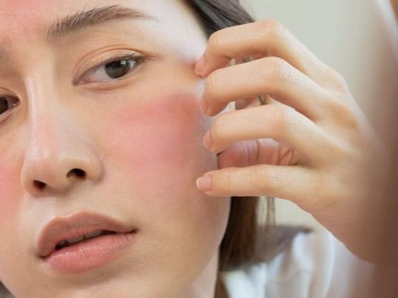 Nguyên tắc vàng trong cách chăm sóc da bị kích ứng