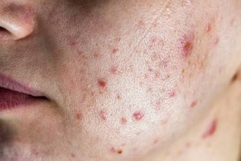 Kết hợp giải pháp nuôi dưỡng da từ bên trong