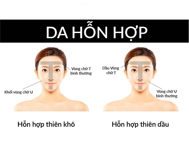 Da hỗn hợp là gì và tại sao lại "khó chiều"?