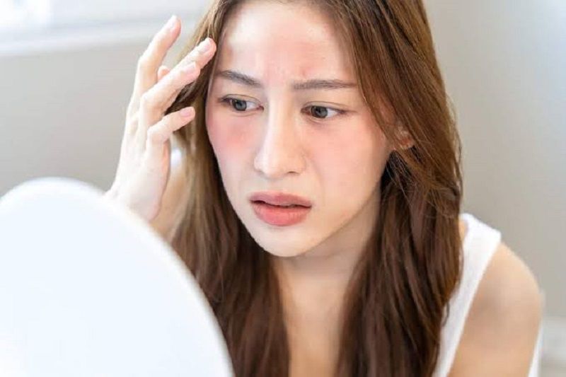 Bản chất của da nhạy cảm và dấu hiệu nhận biết