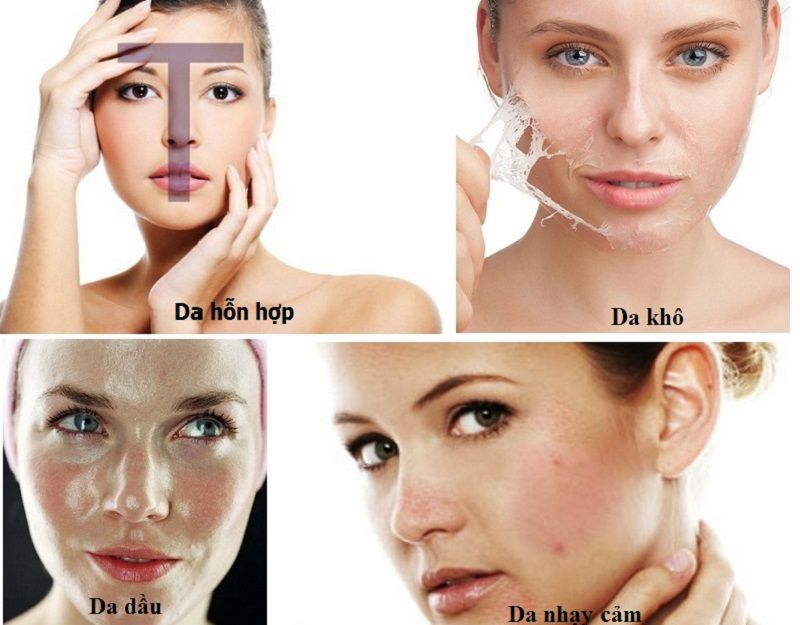 Các loại da cơ bản và đặc điểm nhận biết chuẩn y khoa