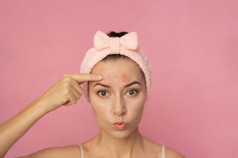 Quy trình chăm sóc da sau khi nặn mụn theo từng mốc thời gian