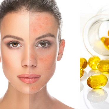 The Collagen ++ Extra Plus - công thức vàng bổ sung dưỡng chất cho da