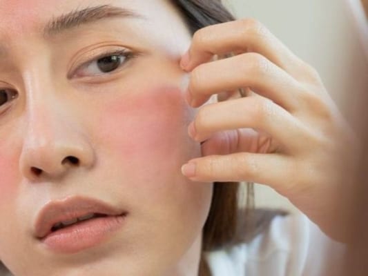 Nguyên tắc vàng trong cách chăm sóc da bị kích ứng